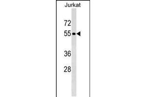Western blot analysis in Jurkat cell line lysates (35ug/lane). (PNMA3 抗体  (C-Term))