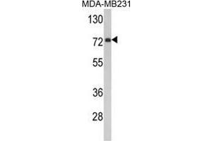 Western blot analysis of FMO3 Antibody (N-term) in MDA-MB231 cell line lysates (35 µg/lane). (FMO3 抗体  (N-Term))