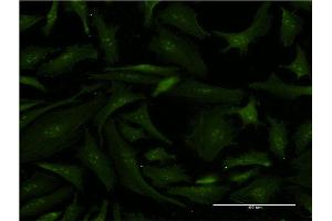 Immunofluorescence (IF) image for anti-Excision Repair Cross-Complementing Rodent Repair Deficiency, Complementation Group 2 (ERCC2) (AA 631-730) antibody (ABIN515385)