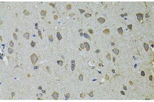 Immunohistochemistry of paraffin-embedded Rat brain using UGDH Polyclonal Antibody at dilution of 1:100 (40x lens). (UGDH 抗体)