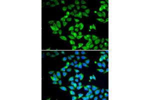 Immunofluorescence analysis of U2OS cells using MAP1LC3B antibody.