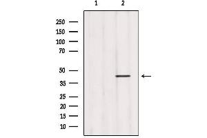 Western Blotting (WB) image for anti-Growth Hormone Secretagogue Receptor (GHSR) (N-Term) antibody (ABIN6257250)