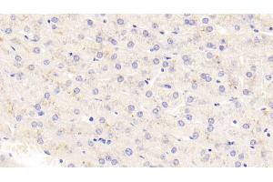 Detection of TSLP in Human Liver Tissue using Polyclonal Antibody to Thymic Stromal Lymphopoietin (TSLP) (Thymic Stromal Lymphopoietin 抗体  (AA 29-159))