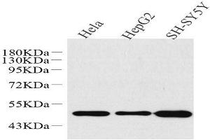 Western Blot analysis of various samples using GLUT-3 Polyclonal Antibody at dilution of 1:1000. (SLC2A3 抗体)