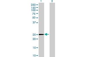 Western Blot analysis of DHRS4L2 expression in transfected 293T cell line by DHRS4L2 MaxPab polyclonal antibody. (DHRS4L2 抗体  (AA 1-230))
