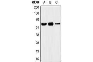 Western Blotting (WB) image for anti-Potassium Voltage-Gated Channel, Shaker-Related Subfamily, Member 5 (KCNA5) (Center) antibody (ABIN7296102)