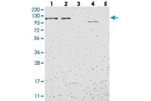Western blot analysis of Lane 1: RT-4, Lane 2: U-251 MG, Lane 3: Human Plasma, Lane 4: Liver, Lane 5: Tonsil with B4GALNT3 polyclonal antibody . (B4GALNT3 抗体)