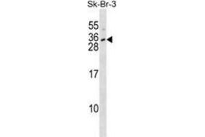 Western blot analysis in SK-BR-3 cell line lysates (35ug/lane) using Interleukin-28B  Antibody (N-term). (IL28B 抗体  (N-Term))