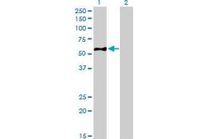 Western Blot analysis of EIF5 expression in transfected 293T cell line by EIF5 monoclonal antibody (M01), clone 2E6-4C12. (EIF5 抗体  (AA 1-431))