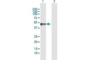 Western Blot analysis of KRT35 expression in transfected 293T cell line by KRT35 MaxPab polyclonal antibody. (Keratin 35 抗体  (AA 1-455))