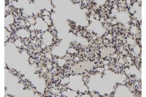 ABIN6273052 at 1/100 staining Mouse lung tissue by IHC-P. (LARP7 抗体  (C-Term))