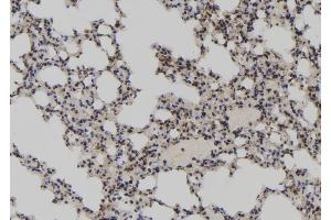 ABIN6273052 at 1/100 staining Mouse lung tissue by IHC-P.