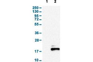 Western Blot analysis of (1) Negative control (vector only transfected HEK293T lysate), and (2) Over-expression lysate (Co-expressed with a C-terminal myc-DDK tag (~3. (Somatostatin 抗体  (AA 25-107))