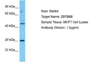 Host: Rabbit Target Name: ZBTB8B Sample Tissue: Human MCF7 Whole Cell Antibody Dilution: 1ug/ml (ZBTB8B 抗体  (C-Term))