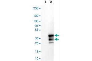 Western Blot analysis of Lane 1: negative control (vector only transfected HEK293T cell lysate) and Lane 2: over-expression lysate (co-expressed with a C-terminal myc-DDK tag in mammalian HEK293T cells) with VPS24 polyclonal antibody . (CHMP3 抗体)