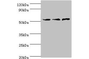 Western blot All lanes: ACVR1C antibody at 4 μg/mL Lane 1: Mouse brain tissue Lane 2: HepG2 whole cell lysate Lane 3: Hela whole cell lysate Secondary Goat polyclonal to rabbit IgG at 1/10000 dilution Predicted band size: 55, 38, 47, 50 kDa Observed band size: 55 kDa