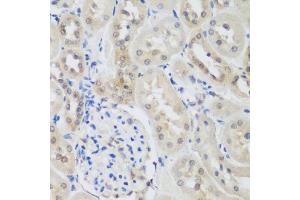 Immunohistochemistry of paraffin-embedded rat kidney using UBE3A antibody (ABIN5975332) at dilution of 1/200 (40x lens). (ube3a 抗体)