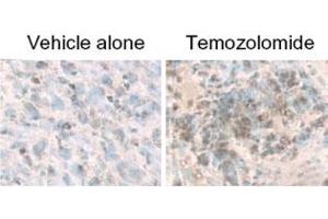 LC3B staining of MAP1LC3B in treated U87-MG cultured & subcutaneous tumors using MAP1LC3B polyclonal antibody . (LC3B 抗体  (AA 1-50))