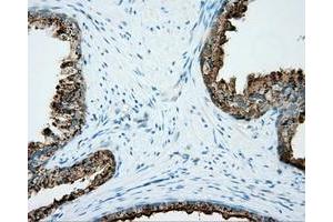 Immunohistochemical staining of paraffin-embedded liver tissue using anti-NME4 mouse monoclonal antibody. (NME4 抗体)