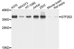Western blot analysis of extracts of various cells, using GTF2E2 antibody. (GTF2E2 抗体)