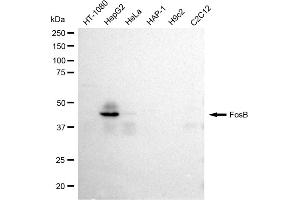 anti-FBJ Murine Osteosarcoma Viral Oncogene Homolog B (FOSB) antibody
