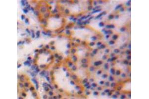 IHC-P analysis of Kidney tissue, with DAB staining. (CTGF 抗体  (AA 25-348))
