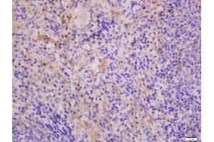 Formalin-fixed and paraffin embedded Rat lung spleen labeled with Anti-THEMIS Polyclonal Antibody, Unconjugated  at 1:300, followed by conjugation to the secondary antibody and DAB staining. (THEMIS 抗体  (AA 301-400))