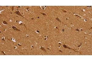 Immunohistochemistry of paraffin-embedded Human brain using NDUFS5 Polyclonal Antibody at dilution of 1:50