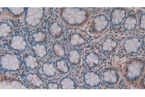 Detection of MMP11 in Human Rectum Tissue using Polyclonal Antibody to Matrix Metalloproteinase 11 (MMP11)