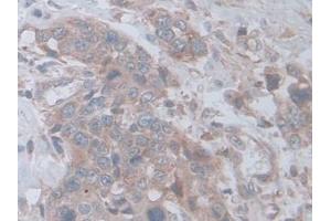 Immunohistochemistry (IHC) image for anti-D-2-Hydroxyglutarate Dehydrogenase (D2HGDH) (AA 56-232) antibody (ABIN7442156)