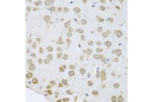 Immunohistochemistry (Paraffin-embedded Sections) (IHC (p)) image for anti-GrpE-Like 2, Mitochondrial (GRPEL2) (AA 33-225) antibody (ABIN6141437)