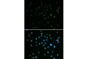 Immunofluorescence analysis of A549 cells using MSH6 antibody (ABIN5971626). (MSH6 抗体)