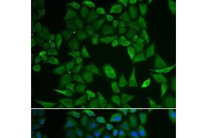 Immunofluorescence analysis of HeLa cells using CLPS Polyclonal Antibody (CLPS 抗体)