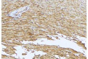 ABIN6273543 at 1/100 staining Mouse muscle tissue by IHC-P. (MRCKG 抗体  (C-Term))