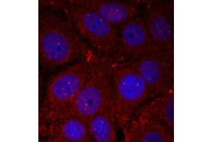 Immunofluorescence staining of methanol-fixed Hela cells using Phospho-SNCA-Y136 antibody. (SNCA 抗体  (pTyr136))
