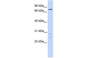 Western Blotting (WB) image for anti-Kelch-Like 4 (KLHL4) antibody (ABIN2458392) (Kelch-Like 4 抗体)