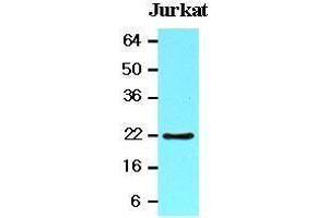 The lysates of Jurkat (20 ug) were resolved by SDS-PAGE, transferred to nitrocellulose membrane and probed with anti-human BID (1:1000). (BID 抗体  (AA 1-195))