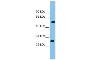 WB Suggested Anti-MEF2D Antibody Titration: 0. (MEF2D 抗体  (Middle Region))