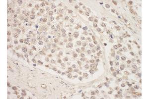 anti-SRSF Protein Kinase 1 (SRPK1) (AA 275-325) antibody