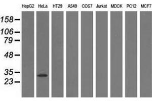 Western blot analysis of extracts (35 µg) from 9 different cell lines by using anti-GSTT2 monoclonal antibody. (GSTT2 抗体)