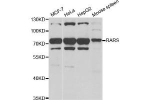 Western Blotting (WB) image for anti-Arginyl-tRNA Synthetase (RARS) antibody (ABIN1980323) (RARS 抗体)