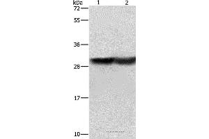 Western blot analysis of Human fetal brain and mouse kidney tissue, using CALB1 Polyclonal Antibody at dilution of 1:600 (CALB1 抗体)