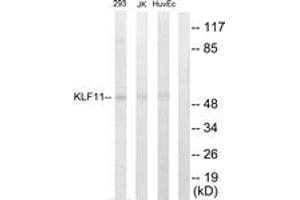Western blot analysis of extracts from 293/Jurkat/HuvEc cells, using KLF11 Antibody. (KLF11 抗体  (AA 1-50))