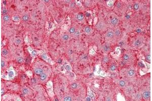 Human Liver (formalin-fixed, paraffin-embedded) stained with APOE antibody ABIN337117 at 2. (APOE 抗体  (AA 305-317))