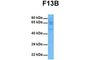 Host:  Rabbit  Target Name:  F13B  Sample Tissue:  Human DLD1  Antibody Dilution:  1. (F13B 抗体  (Middle Region))