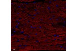 Immunofluorescence (Paraffin-embedded Sections) (IF (p)) image for anti-ATP Synthase, H+ Transporting, Mitochondrial F0 Complex, Subunit C1 (Subunit 9) (ATP5G1) antibody (ABIN7073141)