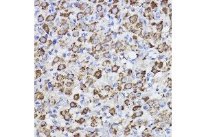 Immunohistochemistry of paraffin-embedded rat ovary using Erlin-2 Rabbit mAb (ABIN7267006) at dilution of 1:100 (40x lens). (ERLIN2 抗体)