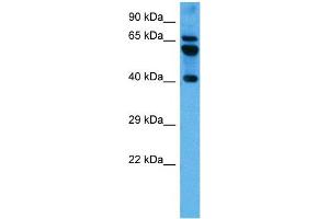 Host:  Mouse  Target Name:  PARD6B  Sample Tissue:  Mouse Brain  Antibody Dilution:  1ug/ml (PARD6B 抗体  (N-Term))