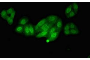 Immunofluorescent analysis of HepG2 cells using ABIN7146747 at dilution of 1:100 and Alexa Fluor 488-congugated AffiniPure Goat Anti-Rabbit IgG(H+L) (NOS1AP 抗体  (C-Term))