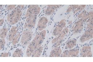Detection of JAM2 in Human Stomach Tissue using Polyclonal Antibody to Junctional Adhesion Molecule 2 (JAM2) (JAM2 抗体  (AA 74-250))